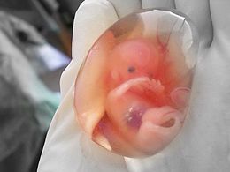 Aborto terapéutico 10 semanas abortar